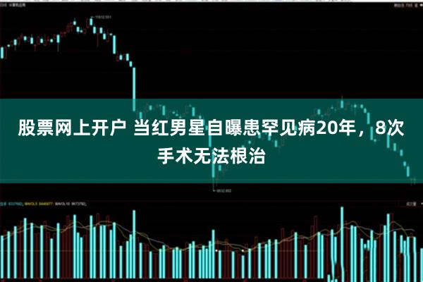 股票网上开户 当红男星自曝患罕见病20年，8次手术无法根治